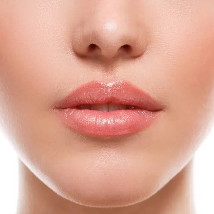 Lip Augmentation