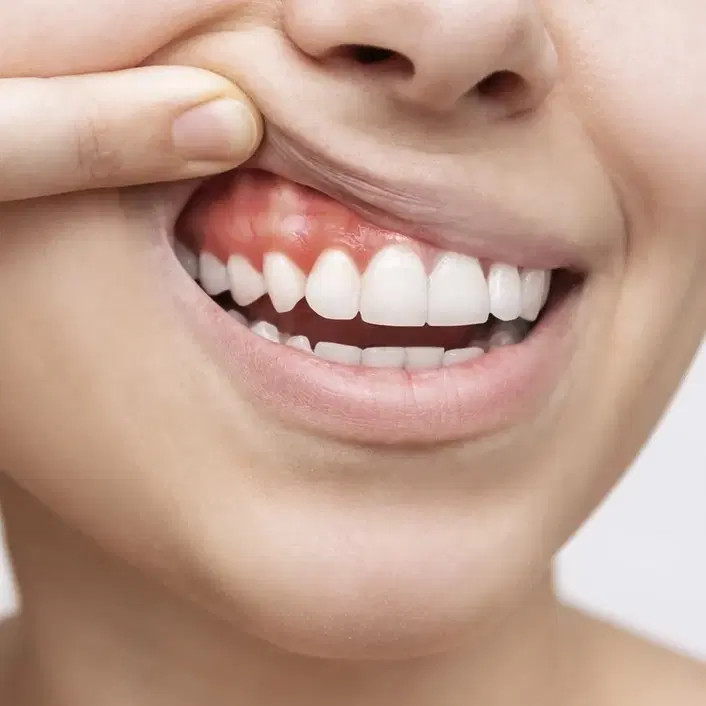 Periodontology