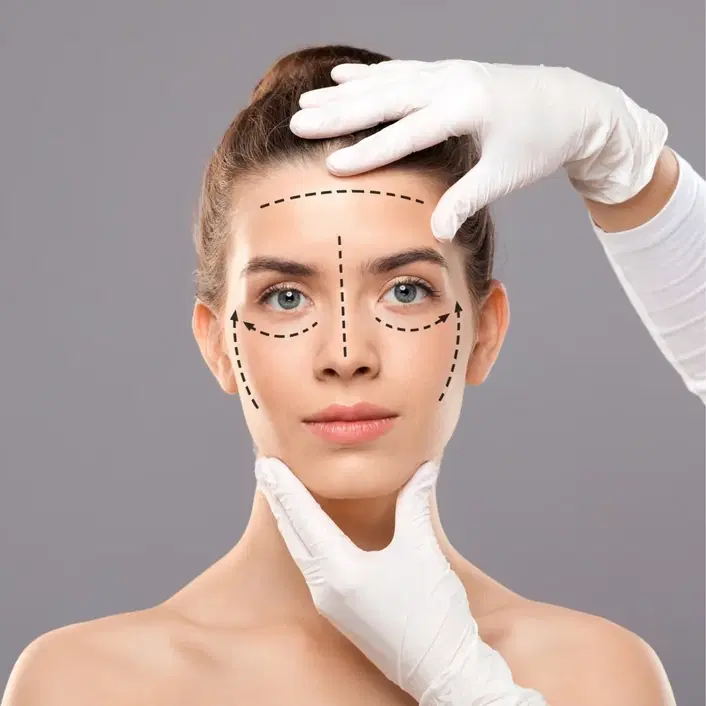 facelift