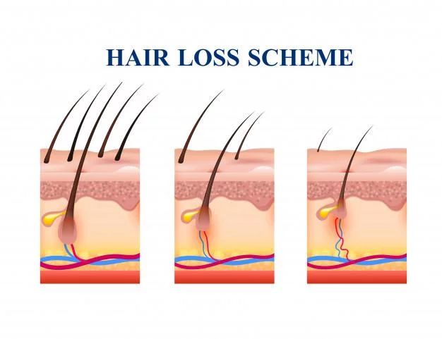 Treatment And Prevention Of Hair Loss - Estheticana image