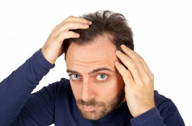 Hair Transplant for Thinning Hair image